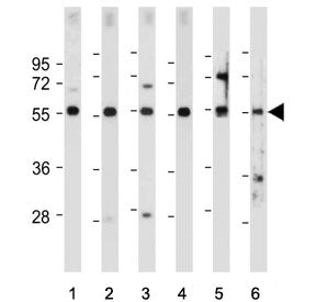 Western blot testing of 1) human HEK293, 2) human U-2 OS, 3) human U-87 MG, 4) human Y79, 5) mouse k