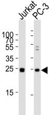 Western blot analysis of lysate from human Jurkat and rat PC-3 lysate using HMGB4 antibody diluted a