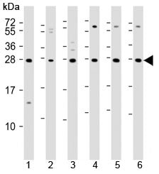 Western blot testing of 1) mouse EL4, human 2) fetal thymus, 3) spleen, 4) HUT78, 5) Jurkat and 6) M