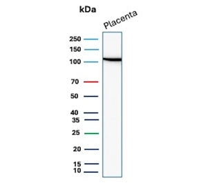 E-Cadherin Antibody / CDH1