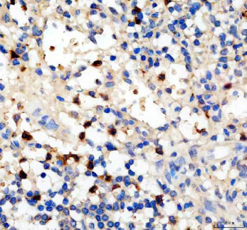 IHC staining of FFPE human spleen tissue with Platelet factor 4 antibody, HRP-secondary and DAB subs