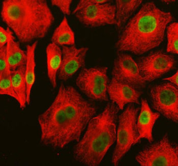 Immunofluorescent staining of PARP15 using anti-PARP15 antibody (green) and anti-Beta Tubulin antibo
