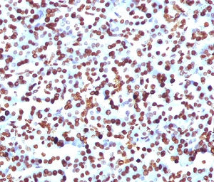 IHC staining of FFPE human pancreas with SOX9 antibody (clone SRYB9-1). HIER: boil tissue sections i