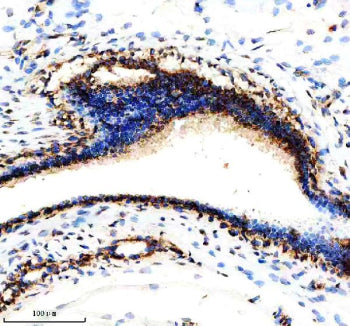 Immunohistochemical staining of NDUFS3 using anti-NDUFS3 antibody. NDUFS3 was detected in a paraffin