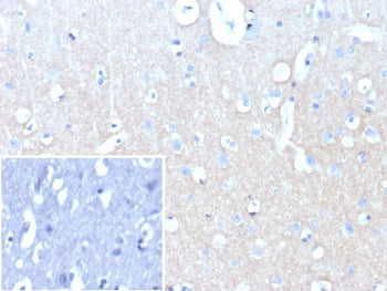 L1CAM Antibody / NCAM-L1 / CD171
