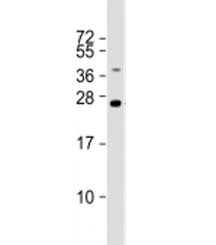 Western blot testing of human liver lysate with TMED4 antibody at 1:2000. Predicted molecular weight