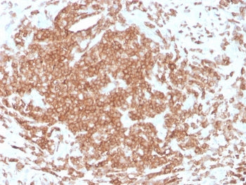 IHC staining of FFPE human tonsil with recombinant CD3e antibody (clone rC3e/1308). HIER: boil tissu
