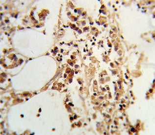 TIMP3 Antibody