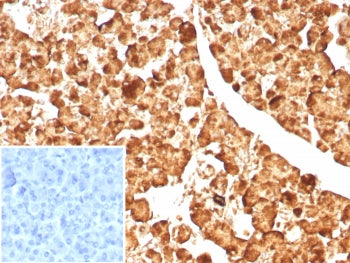 IHC staining of FFPE human pancreas tissue with CPA1 antibody (clone CPA1/8623R). Inset: PBS used in