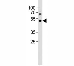 Western blot analysis of lysate from HepG2 cell line using PAX6 antibody; Ab was diluted at 1:1000.