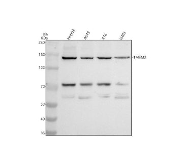 Western blot analysis of CEMIP2 using anti-CEMIP2 antibody. Electrophoresis was performed on a 8% SD