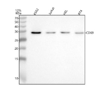Western blot analysis of CD69 using anti-CD69 antibody. Lane 1: human K562 whole cell lysates, Lane