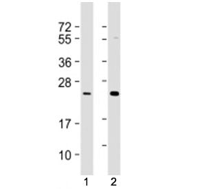 Western blot testing of RAB7L1 antibody at 1:1000-1:2000: Lane 1) human Jurkat and 2) A431 cell lysa