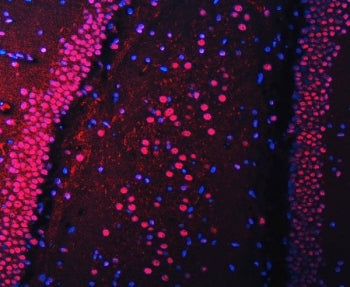 Immunofluorescent staining of FFPE rat brain tissue with RNA-binding protein 22 antibody (red) and D