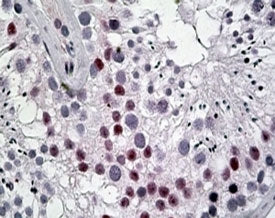 IHC testing of FFPE human human testis with DENTT antibody at 5ug/ml. HIER: steamed with pH6 citrate