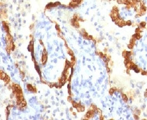 Cytokeratin 18 Antibody