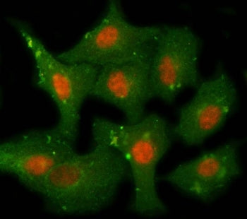 PPM1F Antibody / Protein phosphatase 1F / POPX2