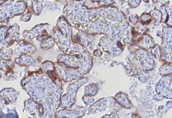 Glypican 3 Antibody / GPC3