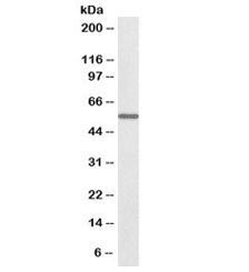 Western blot testing of mouse kidney lysate with biotinylated ALDH6A1 antibody at 0.1ug/ml. Predicte