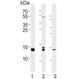 Histone H2B type 1-J Antibody / HIST1H2BJ