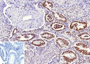 IHC staining of FFPE human endometrium tissue with recombinant TLE1 antibody (clone rTLE1/13032). In