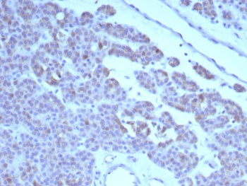 c-RET Antibody