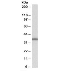 Western blot testing of Daudi lysate with SLC9A3R2 antibody at 1ug/ml. Predicted molecular weight: ~