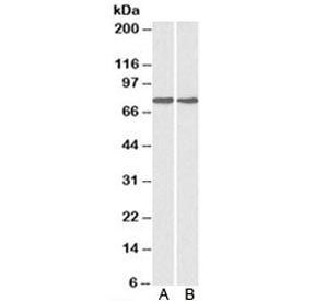 Western blot testing of A) HepG2 and B) MCF7 cell lysate with GRP78 antibody at 0.1ug/ml. Predicted
