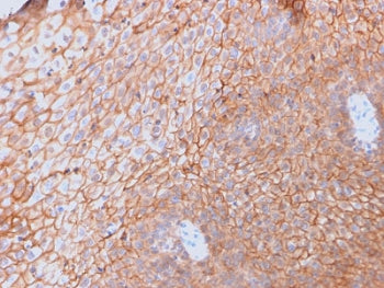 IHC testing of FFPE human spleen with CD40 Ligand antibody (clone CD40LG/2761). HIER: boil tissue se