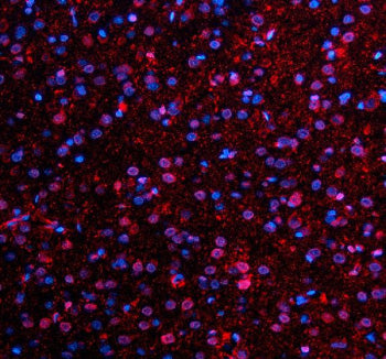 Immunofluorescent staining of NMNAT1 using anti-NMNAT1 antibody (red). NMNAT1 was detected in a para