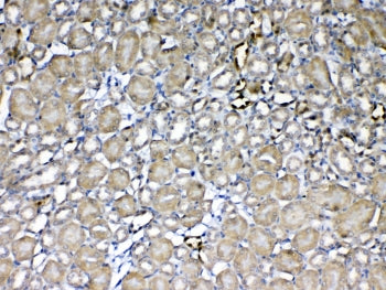 IHC testing of FFPE mouse kidney tissue with GST pi antibody at 1ug/ml. Required HIER: steam section