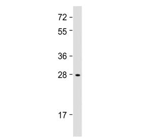 Western blot testing of human Li-7 cell lysate with IGFBP1 antibody at 1:2000. Expected molecular we