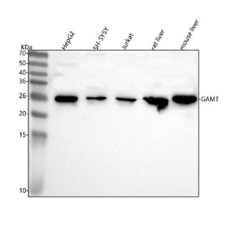 Western blot analysis of GAMT using anti-GAMT antibody. Lane 1: human HepG2 whole cell lysates, Lane