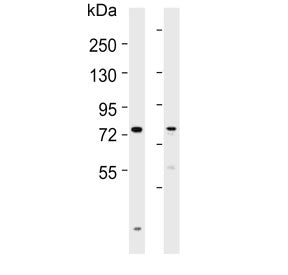 Western blot testing of human 1) liver and 2) ovary lysate with SLCO1B3 antibody. Expected molecular