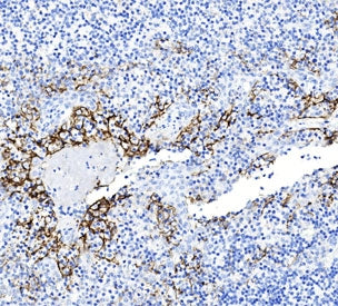 PD-L1 Antibody / B7-H1 / CD274