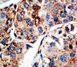 KMT4 Antibody