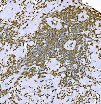 Histone H1.0 Antibody / H1F0