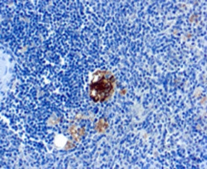 TRAcP Antibody / TRAP / ACP5