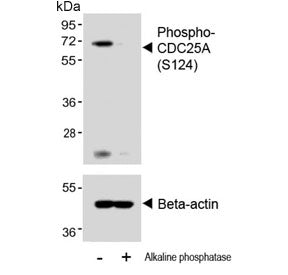 Western blot testing of lysate from human A2780 cells untreated or treated with alkaline phosphatase