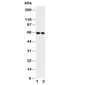 CaMKK2 Antibody