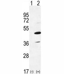 Western blot analysis of IRAK4 antibody and 293 cell lysate either nontransfected (Lane 1) or transi