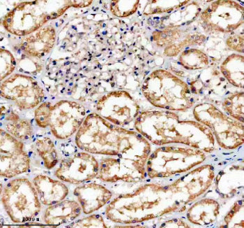 Immunohistochemical staining of TNFRSF10D using anti-TNFRSF10D antibody. TNFRSF10D was detected in a