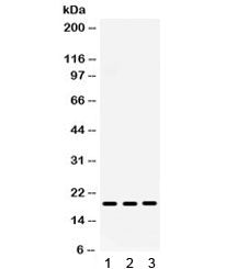 Western blot testing of human 1) placenta, 2) A431 and 3) HeLa lysate with MIG antibody. Expected/ob