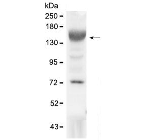 Western blot testing of mouse liver lysate with IGF1R antibody at 0.5ug/ml. Expected molecular weigh