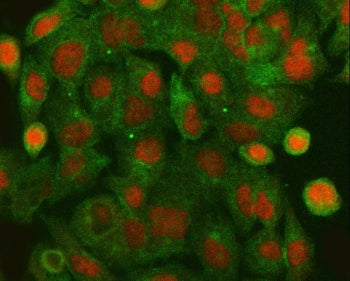 HLTF Antibody / SMARCA3
