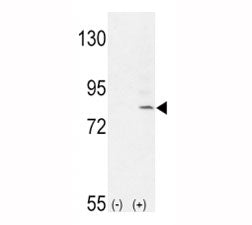 FGFR1 Antibody