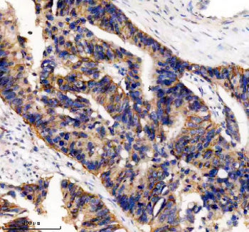 IHC analysis of UBE2A/UBE2B using anti-UBE2A/UBE2B antibody. UBE2A/UBE2B was detected in a paraffin-