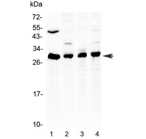 Bcl-2 Antibody (Middle Region)