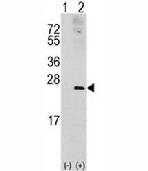 Western blot analysis of RAC1 antibody and 293 cell lysate (2 ug/lane) either nontransfected (Lane 1