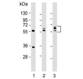 Fibroleukin Antibody / FGL2